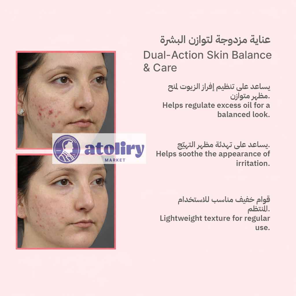 Clasy Care Face Up Face Cream 40ml – Lightweight Daily Blemish Care